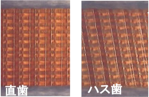 直歯とハス歯の違い