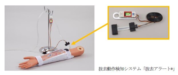 抜去アラートの使用イメージ